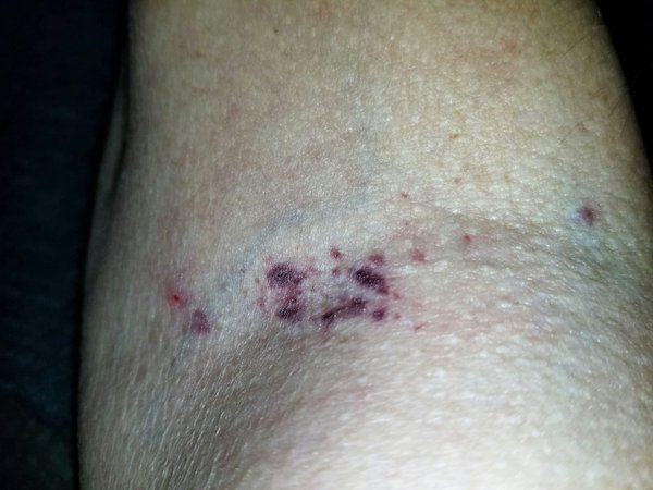 ¿Cómo mejorar tu velocidad de reacción para el fútbol?